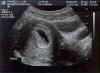 piper ultrasound 1.jpg (43602 bytes)