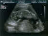 ultra_sound_2_final.jpg (42989 bytes)