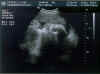 ultra_sound_3_final.jpg (37385 bytes)